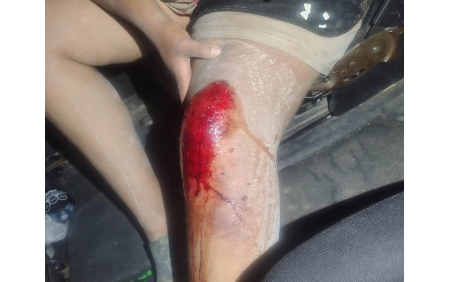 Perros atacan a mujer en moto y a hombre que intentó ayudarla